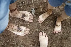 Restless Legs Syndrom effektiv behandeln